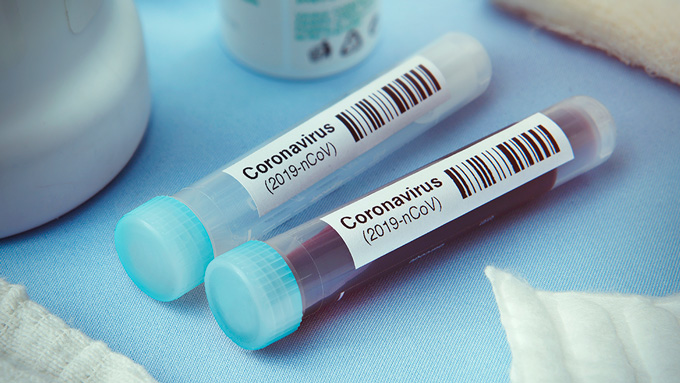 muestras de prueba de coronavirus
